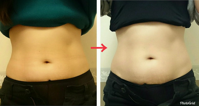 トリートメント２回の変化。ウエストの位置、オヘソの位置が上がり縦に美しいラインに変化。普段の姿勢で圧...