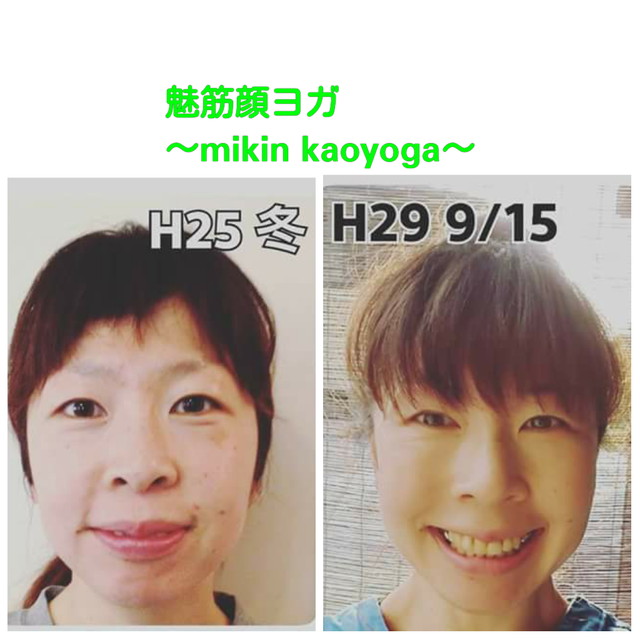 お顔全体に立体感が出来、目・鼻・口の各パーツが美しく際立つ小顔に変身!!頬もリフトupして若々しく健康的...