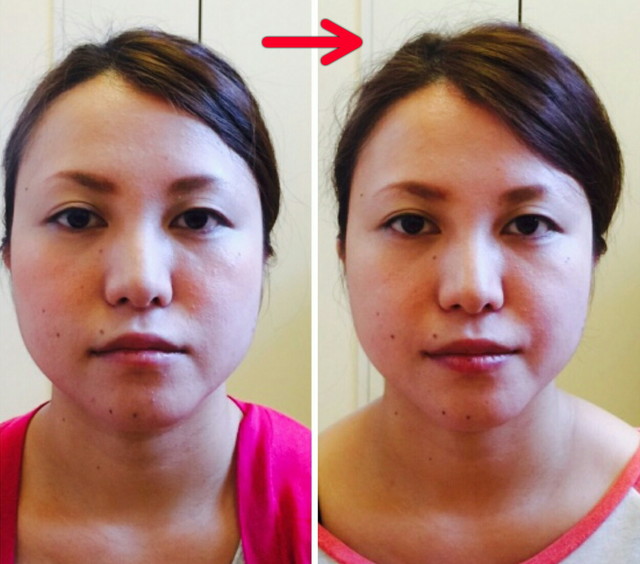 顔ヨガ3回集中プライベートレッスン＋リピートレッスン1回受講の生徒様(スタートから2ヶ月弱での変化)。