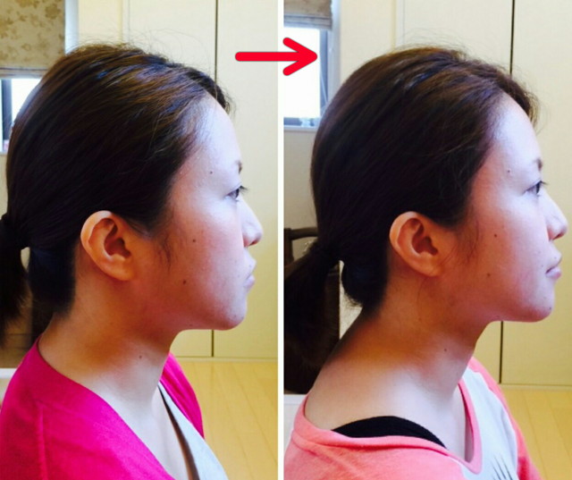 お顔の浮腫がスッキリしてお顔のパーツが更にハッキリとして美人度がまた上がりました!!