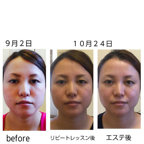 ブライダルエステも同時進行中で更に美しさに磨きを!!