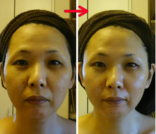 お顔のたるみ・目元の疲労がリセットされ、イキイキとしたスッキリ小顔に変身!!頬のお肉がリフトupされた事...